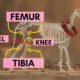 When to Put a Dog down With Torn Acl 8 Put a Dog down With Torn Acl